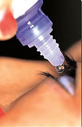 Curso del glaucoma durante el embarazo es muy variable