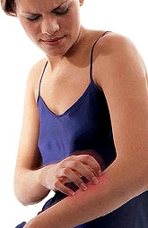 Elevada prevalencia de factores de riesgo cardiovascular en pacientes con psoriasis