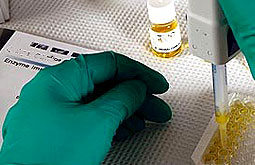 Biomarcadores de acontecimientos cardiovasculares tendrían poca eficacia