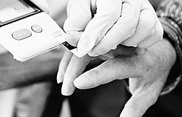 Resistencia a la insulina predice progresión de la diabetes tipo 1