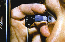 Examen ocular permite medir evolución de la esclerosis múltiple