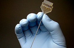 Estimulación cerebral profunda mejora las cefaleas en racimo