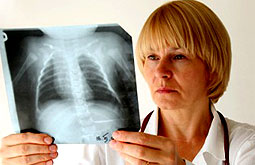 Hipovitaminosis D predispone a la aterosclerosis y enfermedad coronaria