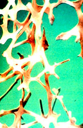 Falta de estrógenos estimula formación de osteoclastos