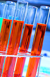 Apolipoproteínas predicen mejor el riesgo de infarto de miocardio