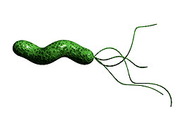 Erradicar el <em>H. pylori</em> previene recurrencia de carcinomas gástricos