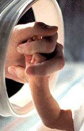 Exposición fetal al sulfato de magnesio previene la parálisis cerebral
