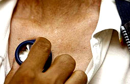 Moxifloxacino acelera mejoría en pacientes con tuberculosis