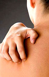 La psoriasis tiene mayor riesgo de diabetes e hipertensión