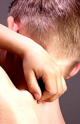 Mupirocina e hipoclorito de sodio reducen síntomas de la dermatitis atópica