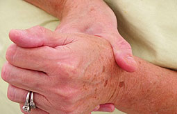 Infliximab mejora los síntomas clínicos de la artritis reumatoide