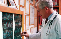 Eritropoyetina reduce deterioro neurológico en la hemorragia intracerebral