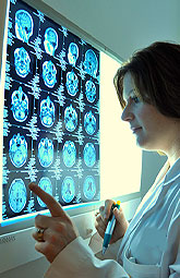 Pregabalina y amitriptilina alivian dolor de la neuropatía diabética periférica