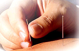 Adenosina regula los efectos analgésicos de la acupuntura