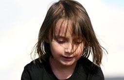Trasplante de médula mejora calidad de vida y lesiones en la epidermólisis bulosa