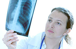 Sarcoidosis altera función vascular y estado inflamatorio