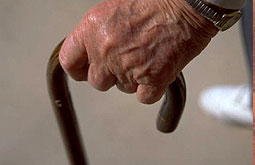 Pacientes con Parkinson tienen más riesgo de melanoma