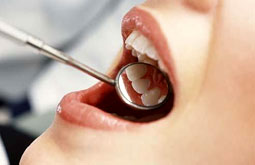 La calprotectina evidencia la periodontitis agresiva