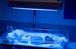 La fototerapia neonatal puede desarrollar lunares