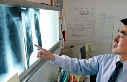 Radiografía anual de tórax no reduce mortalidad por cáncer de pulmón