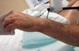 Incidencia de cáncer en pacientes trasplantados es más alta