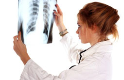 Capacidad funcional predice la supervivencia en el carcinoma pulmonar no microcítico
