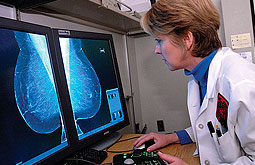Densidad mamaria eleva la posibilidad de cáncer