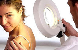 Fumar provoca carcinoma de células escamosas