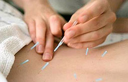 La acupuntura alivia el dolor crónico
