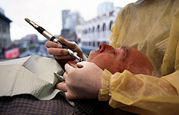 Tratamiento intensivo de la periodontitis mejora la función endotelial
