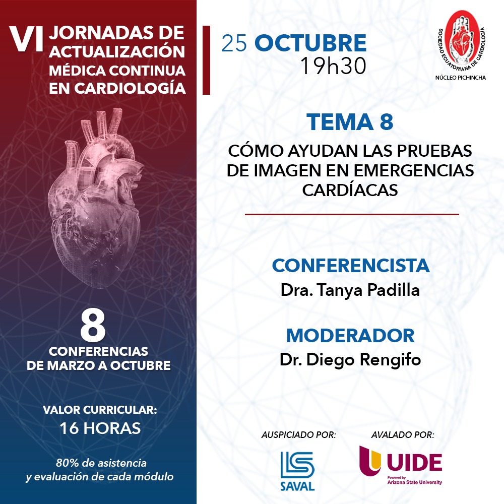 Cómo ayudan las pruebas de imagen en emergencias cardiacas