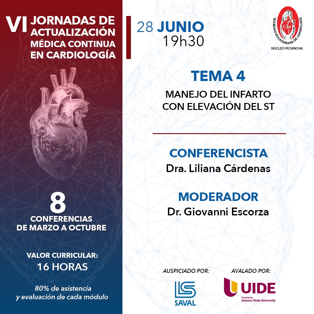 Manejo de infarto con elevación del ST