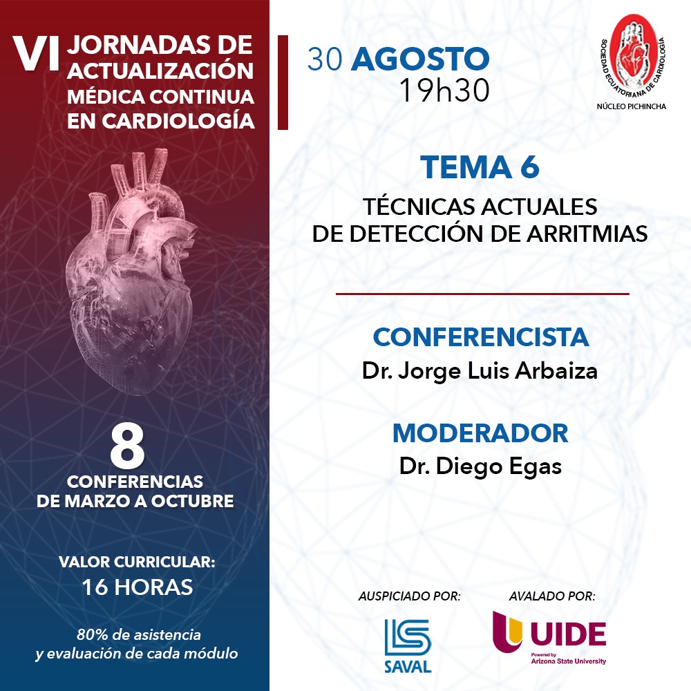 Técnicas actuales en detección de arritmias
