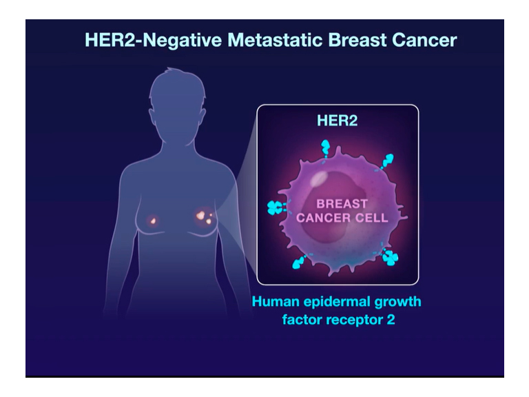 Trastuzumab deruxtecan muestra eficacia en cáncer de mama