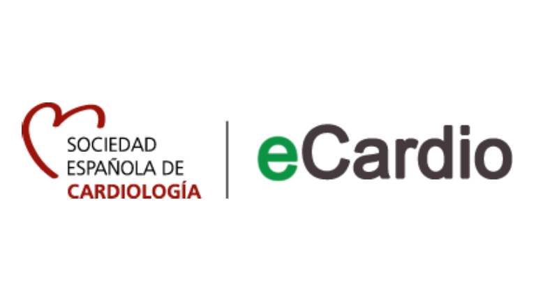 eCardio