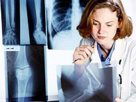 Niños con sobrepeso reportan más fracturas y complicaciones musculoesqueléticas