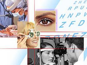 Edema macular empeora la agudeza visual en pacientes con uveítis