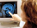 El cerebro responde primero a situaciones de recompensa y después al riesgo