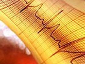 Fibrilación atrial mejora capacidad de ejercicio y calidad de vida