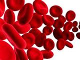 Normalizar la hemoglobina no reduce episodios cardiovasculares en la nefropatía crónica