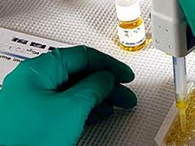 Biomarcadores de acontecimientos cardiovasculares tendrían poca eficacia