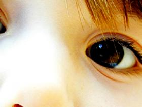 Azitromicina bianual reduce tasas de infecciones oculares por clamidia