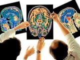 Factor VII reduce hematomas pero no mortalidad en la hemorragia intracerebral