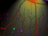 Estimulación transcraneal mejora la memoria en el Alzheimer