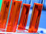 Apolipoproteínas predicen mejor el riesgo de infarto de miocardio