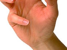 Vitamina D alivia los síntomas del lupus eritematos sistémico