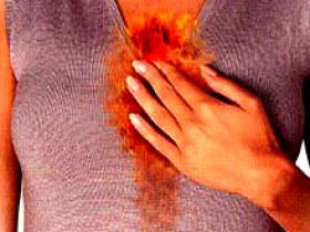 Síndrome metabólico aumenta tasa de esofagitis por reflujo