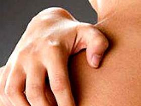 La psoriasis tiene mayor riesgo de diabetes e hipertensión
