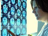 Pregabalina y amitriptilina alivian dolor de la neuropatía diabética periférica
