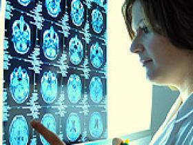 Pregabalina y amitriptilina alivian dolor de la neuropatía diabética periférica